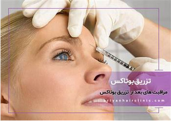 مراقبت های بعد از انجام بوتاکس